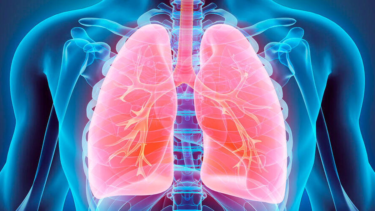 Repotrectinib bei ROS1-NSCLC und NTRK-Tumoren