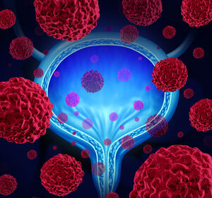 Neoadjuvante Therapieschemata kombiniert mit adjuvanter Therapie bei muskelinvasivem Blasenkrebs vor bzw. nach radikaler Zystektomie