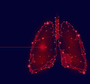 Kräfte bündeln – zielGENau e.V. vernetzt Lungenkrebs-Betroffene mit Treibermutationen