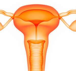 ATHENA-Studie: Verbessertes PFS mit Rucaparib-Erhaltungstherapie beim fortgeschrittenen Ovarialkarzinom 