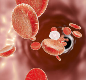 Myelofibrose: Beeinflusst eine frühere Ruxolitinib-Therapie das Gesamtüberleben?