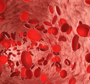 Niedrigrisiko-MDS: Dauerhafter Therapieerfolg bis hin zur Transfusionsfreiheit mit Luspatercept* möglich