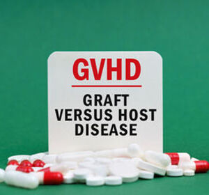 GvHD: Bei wem wird Ruxolitinib eingesetzt?