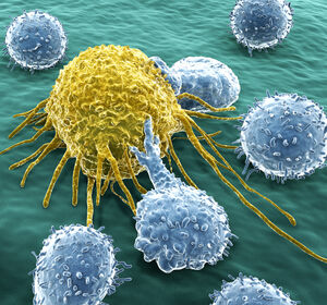 Translation der CAR-T-Zell-Technologie: solide Tumoren und Autoimmunerkrankungen im Fokus