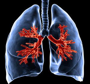 Feinstaubbelastung erhöht Lungenkrebsrisiko auch bei Nicht-Raucher:innen