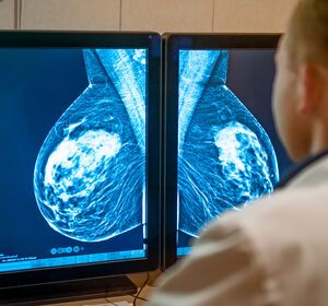 Neue Altersgrenzen beim Mammographie-Screening – was bedeutet dies für die gynäko-onkologische Praxis?