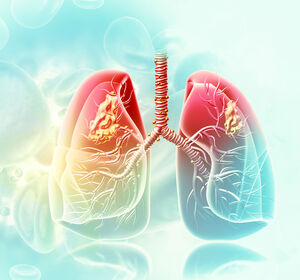 Fortgeschrittenes NSCLC: COSTAR Lung