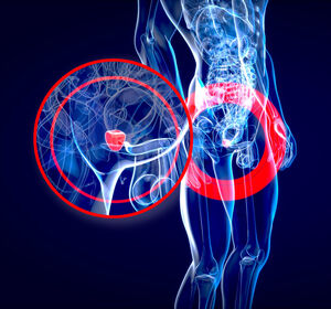 Ossär metastasiertes Prostatakarzinom: Die Osteoprotektion ist eine evidenzbasierte Empfehlung
