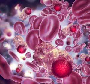 Ropeginterferon alfa-2b: Optimale Krankheitskontrolle bei Polycythaemia Vera