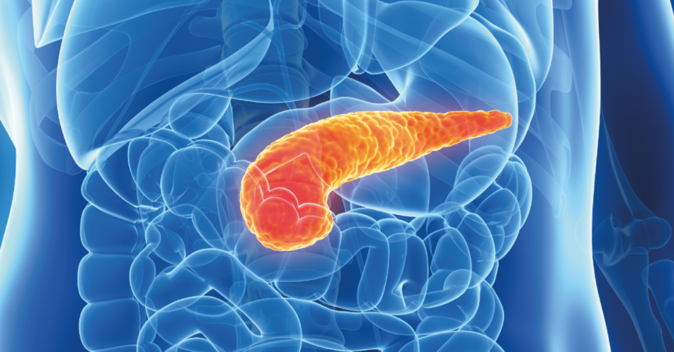 Pankreaskarzinom: Keimbahn und Tumor bewerten