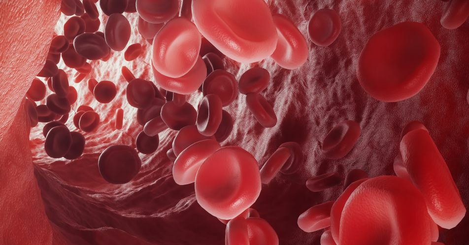 BEYOND-Studie: Luspatercept bei nicht-transfusionsabhängiger β-Thalassämie