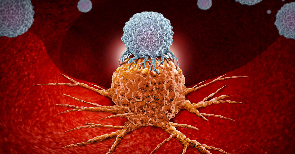 Gynäkologische Onkologie – HRD-GIS als therapierelevanter Biomarker?