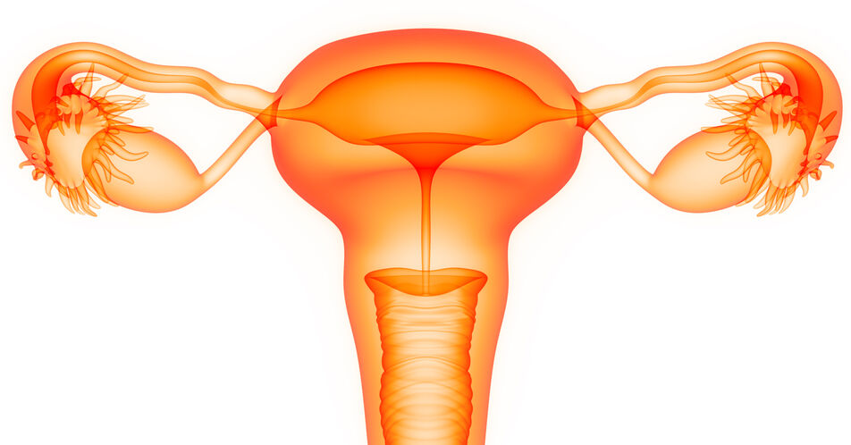 ATHENA-Studie: Verbessertes PFS mit Rucaparib-Erhaltungstherapie beim fortgeschrittenen Ovarialkarzinom