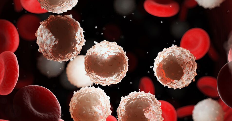 CLL13-Studie: Venetoclax/Obinutuzumab +/- Ibrutinib verlängert PFS gegenüber Chemoimmuntherapie bei der CLL