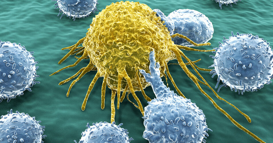 Translation der CAR-T-Zell-Technologie: solide Tumoren und Autoimmunerkrankungen im Fokus