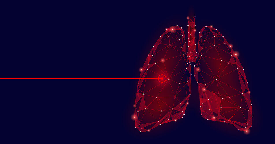 Kräfte bündeln – zielGENau e.V. vernetzt Lungenkrebs-Betroffene mit Treibermutationen
