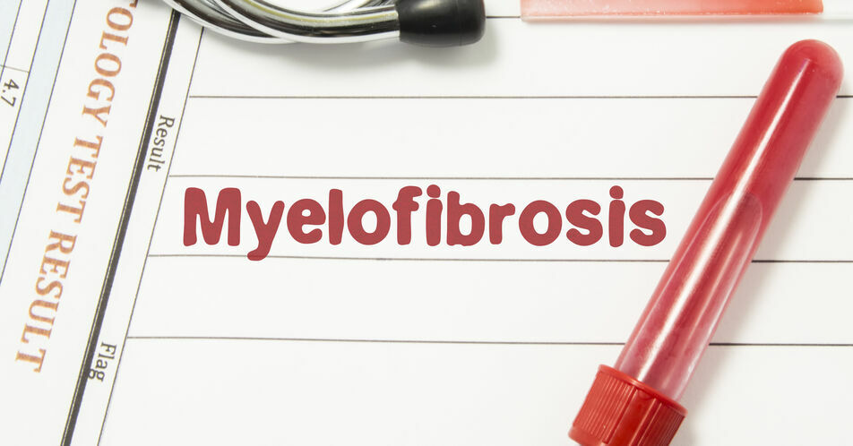Myelofibrose: Kombination aus BET- und JAK-Inhibitoren gut verträglich und wirksam
