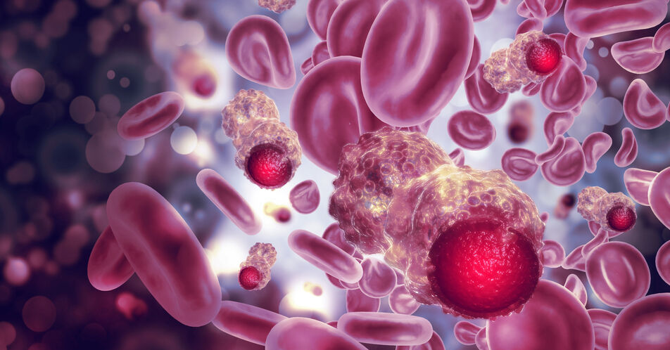 Polycythaemia vera – Der seltene Blutkrebs