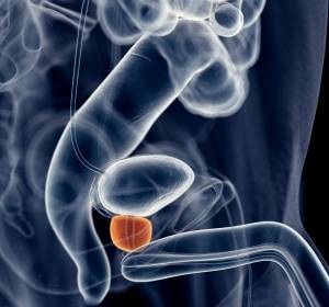 Prostatakrebs: Nuklearmedizinische Therapie identifiziert und zerstört den Tumor
