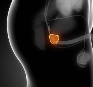 Prostatakrebs: Nuklearmedizinisches Untersuchungs- und Therapieverfahren