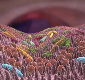 CRC: Rolle des intestinalen Mikrobioms bei der Tumorgenese