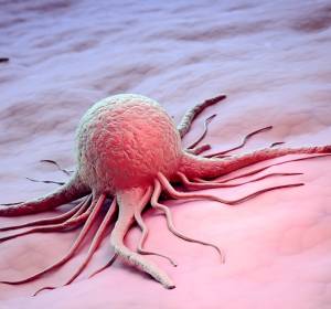Myc-Proteine als Angriffspunkt in der Tumortherapie nutzbar machen