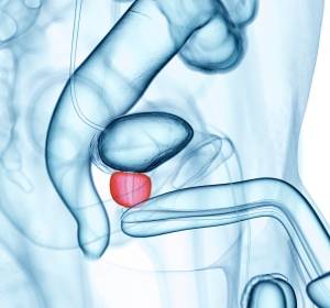 Patienten-Webseite macht auf Früherkennung von Prostatakrebs aufmerksam