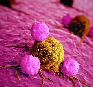 Eine "große Koalition" zur Bekämpfung von seltenen Tumorentitäten