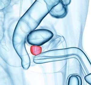 Paradigmenwechsel in der Prostatakrebs-Diagnostik
