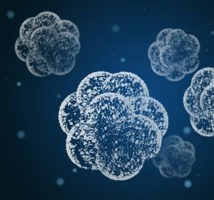 GvHD: Komplikationsrisiko nach Stammzelltransplantation frühzeitig erkennen