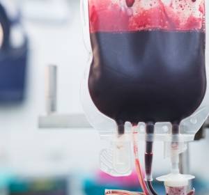 Transfusionsbedingte Eisenüberladung: Weniger Komplikation durch Optimierung der Chelattherapie