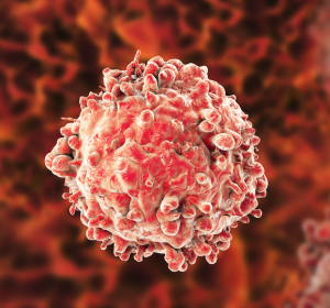 Pankreaskrebs: Flexibilität der Krebszelle bestimmt, wo eine Metastase entsteht