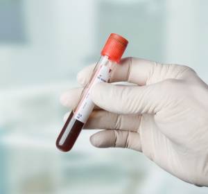 Liquid Biopsy: Schwachstellen des Tumors im Blut erkennen