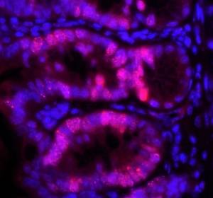 Mausmodell: Fehlerhafte DNA-Reparatur in Darm-Stammzellen führt zu Krebs