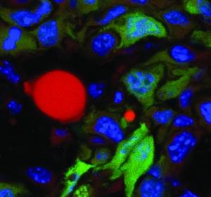 Mausmodell: Rosiglitazon + Trametinib fördern Umwandlung von Brustkrebszellen in Adipozyten