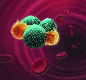 Metastasierung: Neutrophile eskortieren zierkulierende Tumorzellen