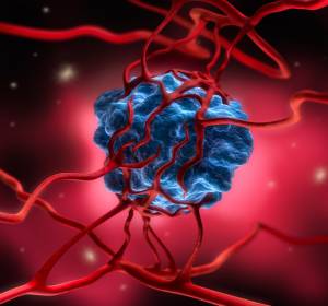 Trennung von kranken und gesunden Blutzellen: Physiker prüfen medizische Anwendbarkeit 