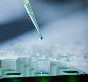 Frühes TNBC: Zirkulierende Tumor-DNA zur Abschätzung des Rezidivrisikos