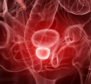 Prostatakarzinom: Krankheitskontrolle durch radiochirurgische Behandlung 