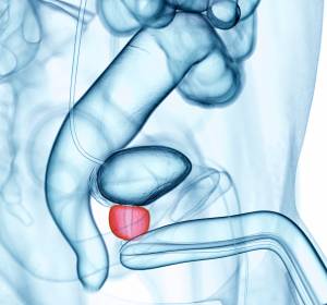 Prostatakarzinom: Positionspapier der DGU zum Screening mittels PSA-Test