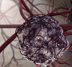 Krebszellen: Unsichtbar für das Immunsystem