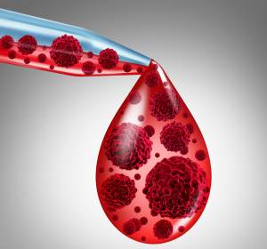 Leukämien: Zellkommunikation bei Blutbildung