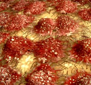 Metastasen: Ursache Makrophagen?