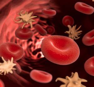Immunthrombopenie: Diagnostik und Therapie