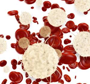 GAZELLE-Studie: Obinutuzumab wird als Kurzinfusion beim unvorbehandelten FL evaluiert