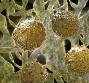 Adenovirus-Infektion nach Stammzelltransplantation: Arsentrioxid stärkt körpereigene Abwehr 
