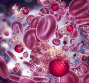 Zur Zukunft der Hämatologie und Onkologie: Ein Update