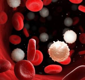 Myeloische und T-Zell-Antigen-exprimierende mehrdeutige Akute Leukämien: Hämatopoetische Stammzelle ein möglicher Ursprung