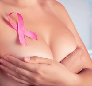 Mammakarzinom: Individualisierte Optionen bei HER2-positivem Brustkrebs