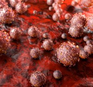 Humane Papillomviren: Pathogenesemechanismus zur Krebsentstehung – via mitochondriale ATP-Synthase